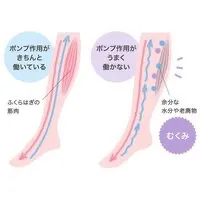 ふくらはぎの浮腫み